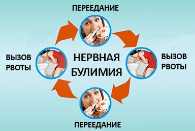 Лечение булимии в Нефтеюганске